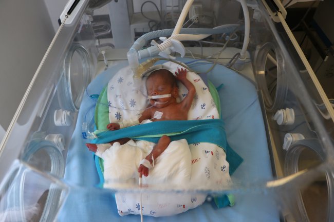 495 Gram Doğan 'Parmak Bebek' Kök Hücre Nakliyle Hayata Tutundu