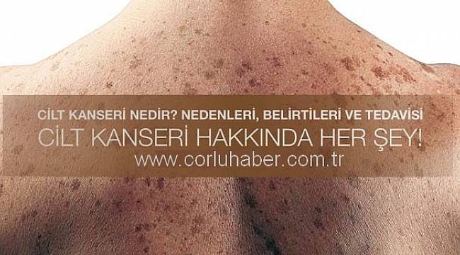 Cilt Kanserine Dikkat!