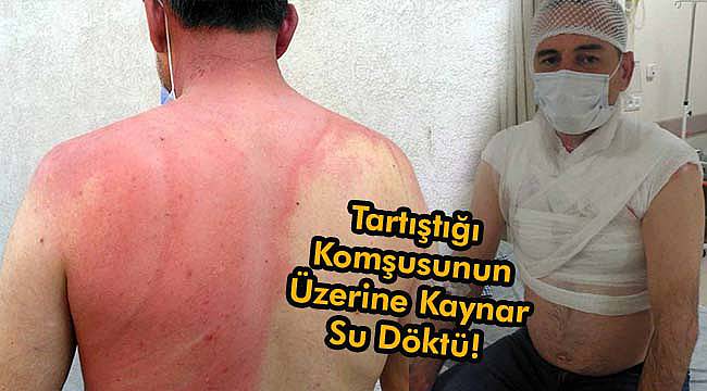 Tartıştığı Komşusunun Üzerine Kaynar Su Döktü!