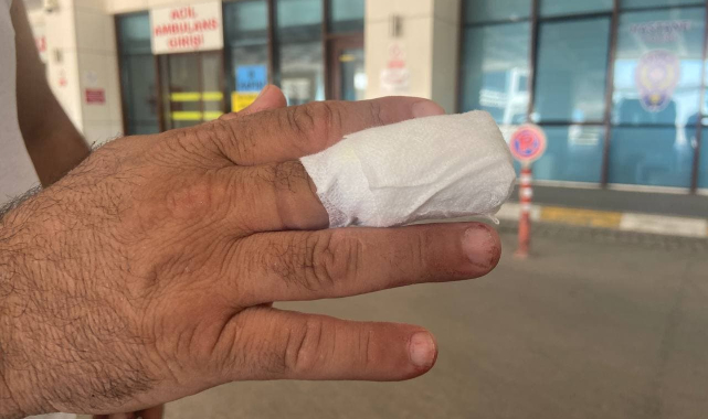 Acemi Kasaplar Hastanelik Oldu