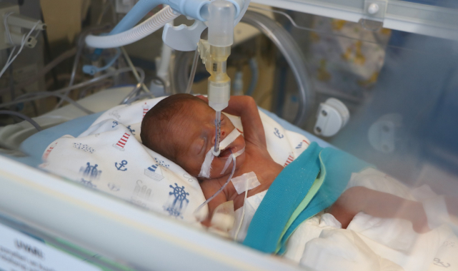 495 Gram Doğan 'Parmak Bebek' Kök Hücre Nakliyle Hayata Tutundu