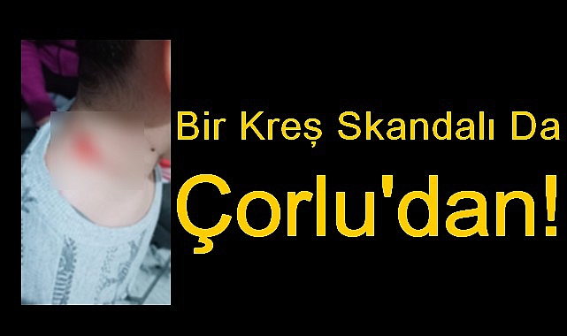 Bir Kreş Skandalı Da Çorlu’dan!