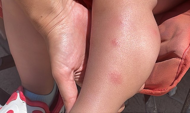 Tatilciler ve İlçe Sakinleri Sivrisineklerden Dertli