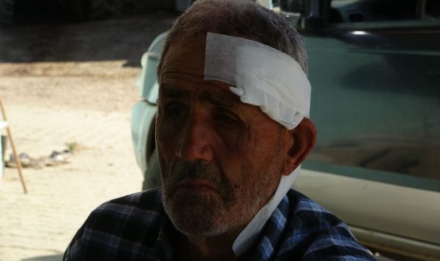 72 yaşındaki çoban, başıboş köpek saldırısında yaralandı