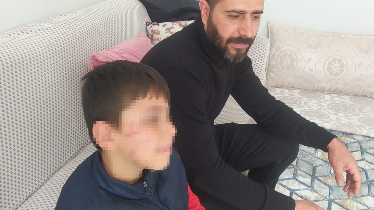 İlkokulda öğrencilerin kavgasına veli de karıştı; 1 yaralı