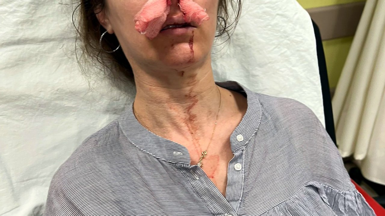 Eşinin sevgilisi sandığı kadını darbettiği 'otomobil kapısı', 'silah' sayıldı