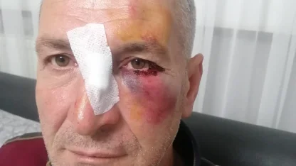Dairesinin önüne hayvan dışkısı atan komşusundan, bu kez 'yüzüne kapı çarptığı' için şikayetçi oldu