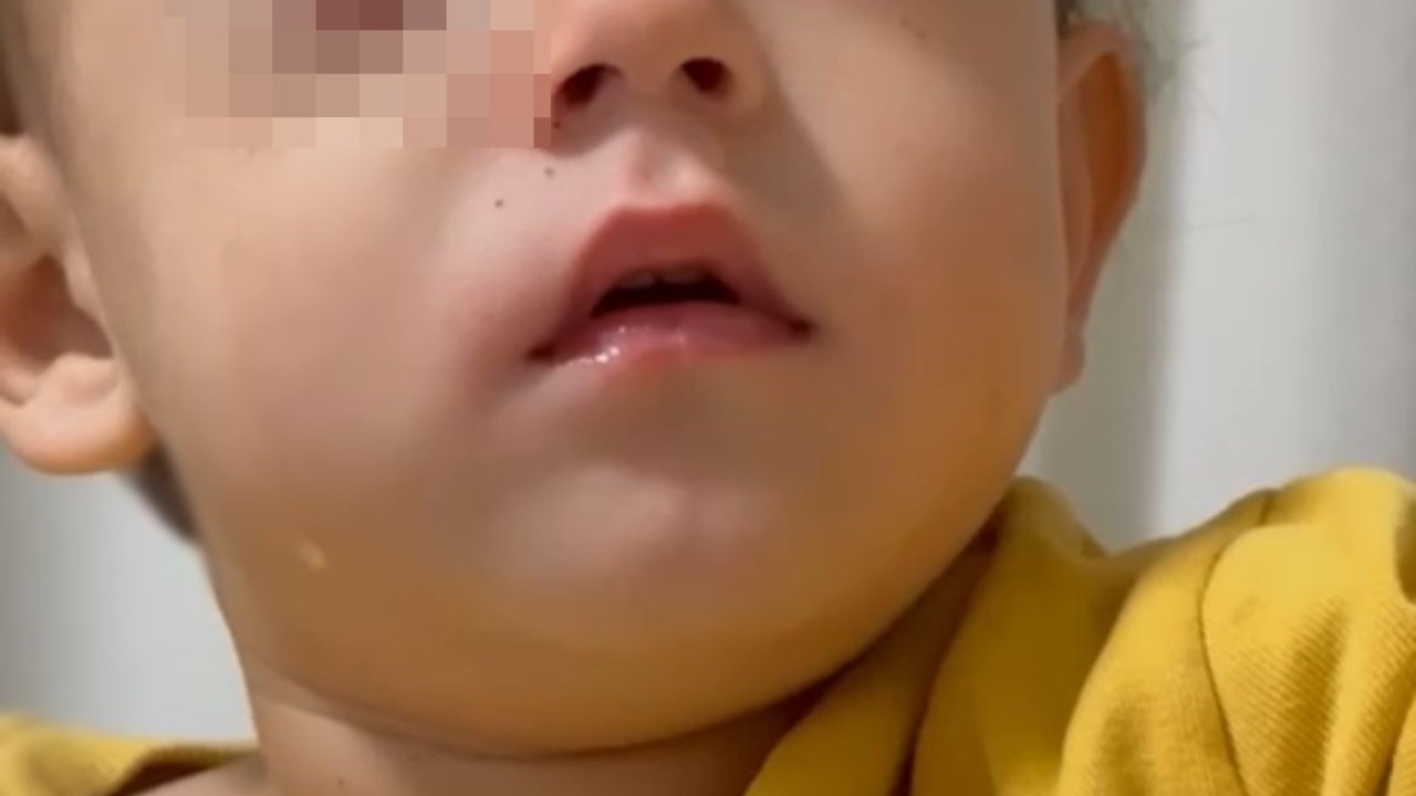 Bursa&#039;da, 2 yaşındaki Alpaslan&#039;ın görme yetisini kaybetmesine neden olan torpil, fırından alınmış