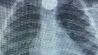 3 yaşındaki Bilal'in, yuttuğu 50 kuruş yemek borusunda takıldı