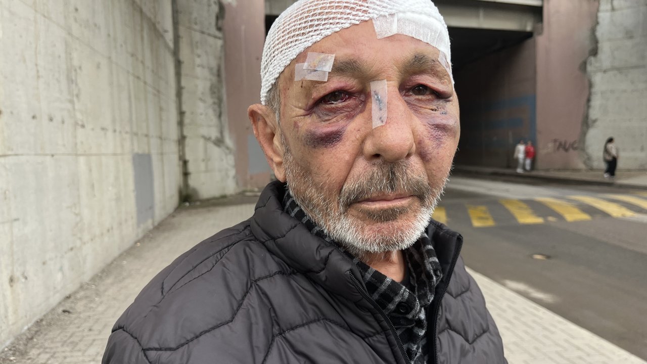 Önce çakmak istediler ardından sokak ortasında darbettiler