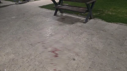 Bursa'da parkta bıçaklı kavga: 1 yaralı