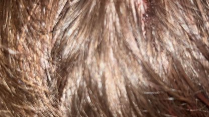 Kucağında bebeği ile darbedilen babanın oğlu, sokakta başına atılan taşla yaralandı