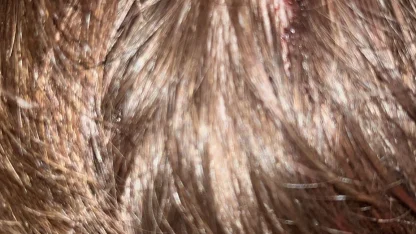 Kucağında bebeği ile darbedilen babanın oğlu, sokakta başına atılan taşla yaralandı