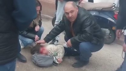 Devrilen motosikletteki kardeşler yaralandı; ağlayan çocuğu çevredekiler sakinleştirdi